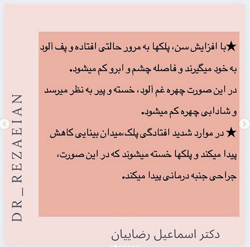 جراحی زیبایی پلک یا بلفاروپلاستی  