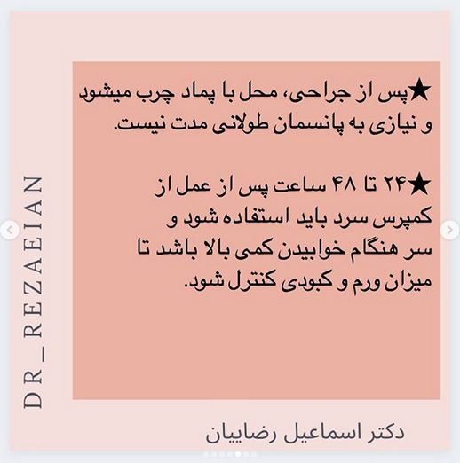 جراحی زیبایی پلک یا بلفاروپلاستی  